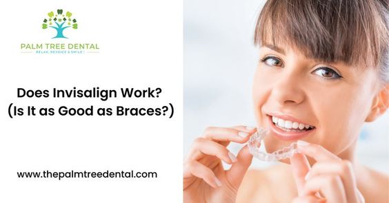 Does Invisalign Work? (Is It as Good as Braces?) — Palm Tree Dental