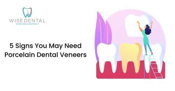 5 Signs You May Need Porcelain Dental Veneers — wisedentaltx