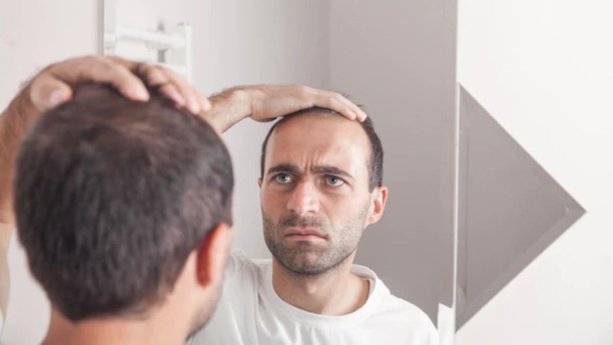 Minoxidil For Men: An Overview