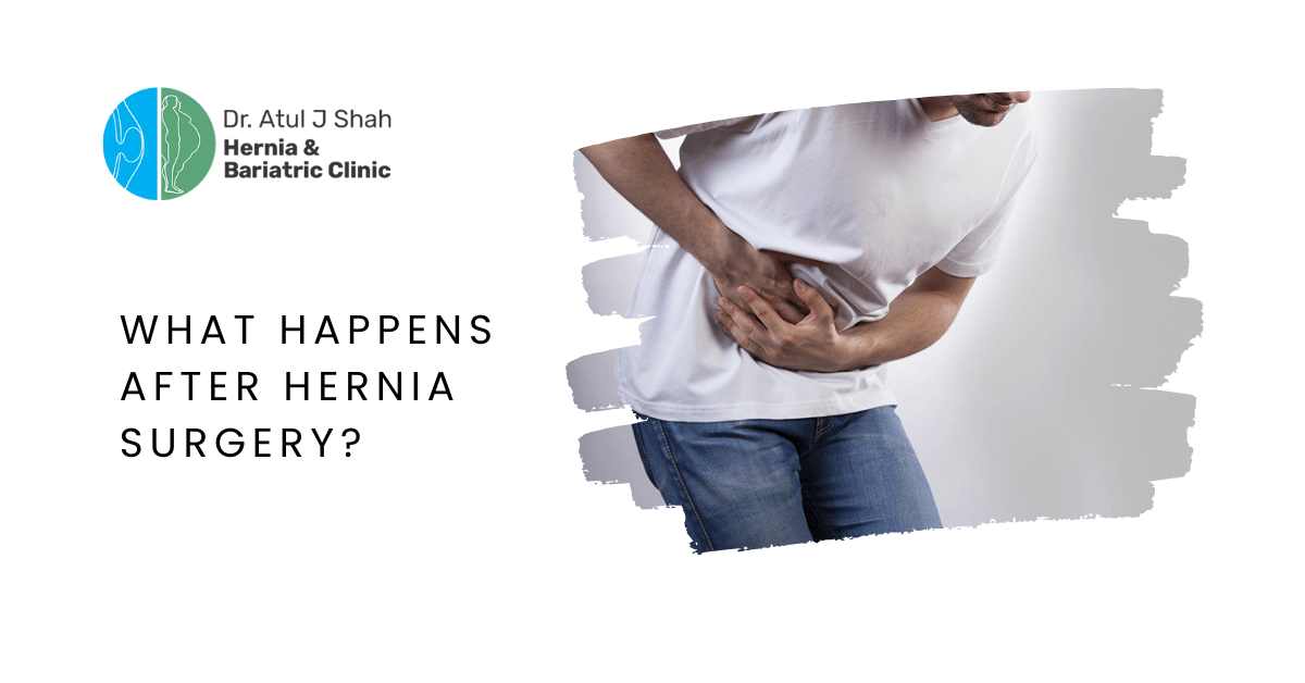 What Happens After Hernia Surgery? | Dr. Atul Shah